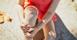 Trucs et astuces : soigner naturellement les coups, bleus et écorchures